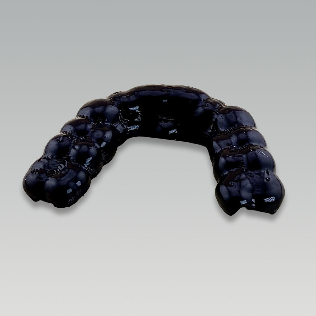 2. ULTRAPROTECT (sans scan)